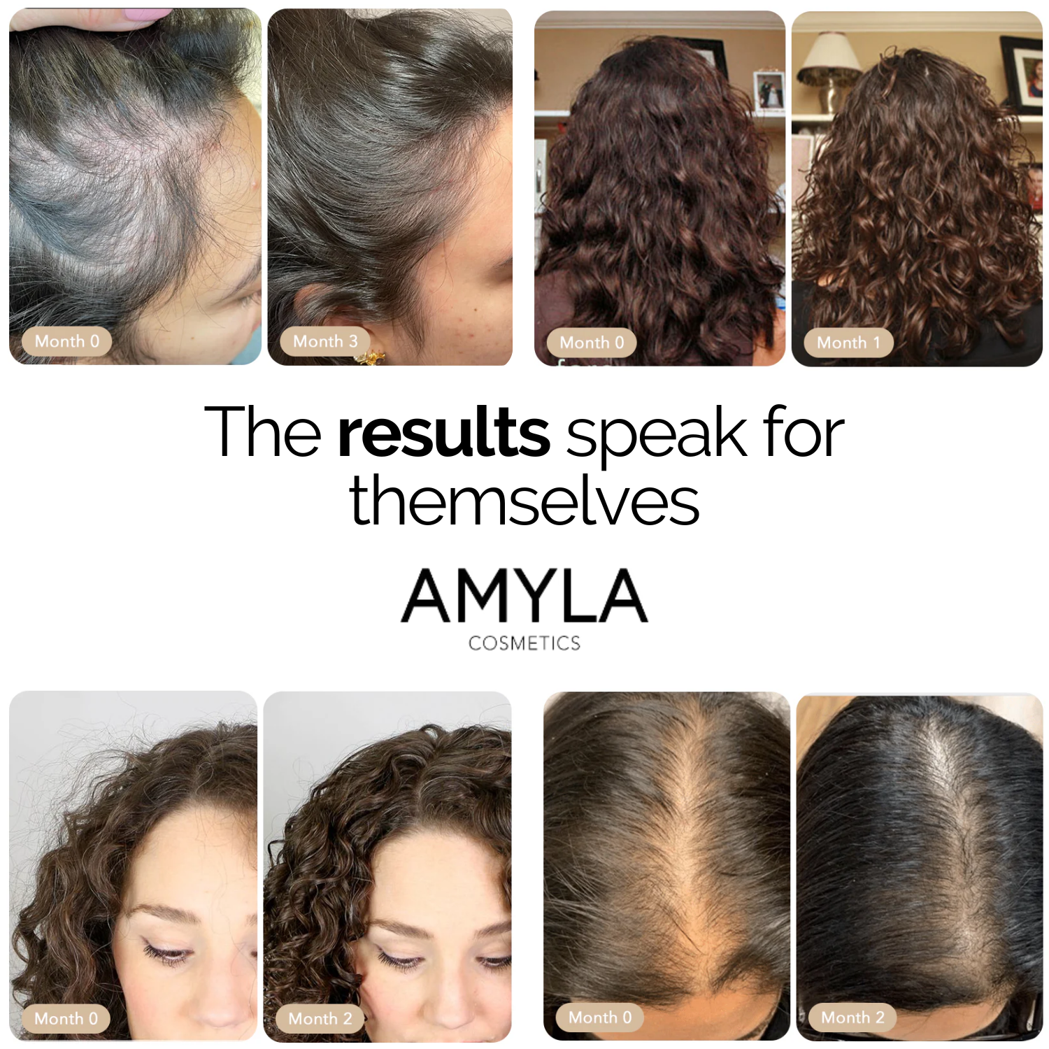 Après-shampoing sans rinçage pour la croissance des cheveux