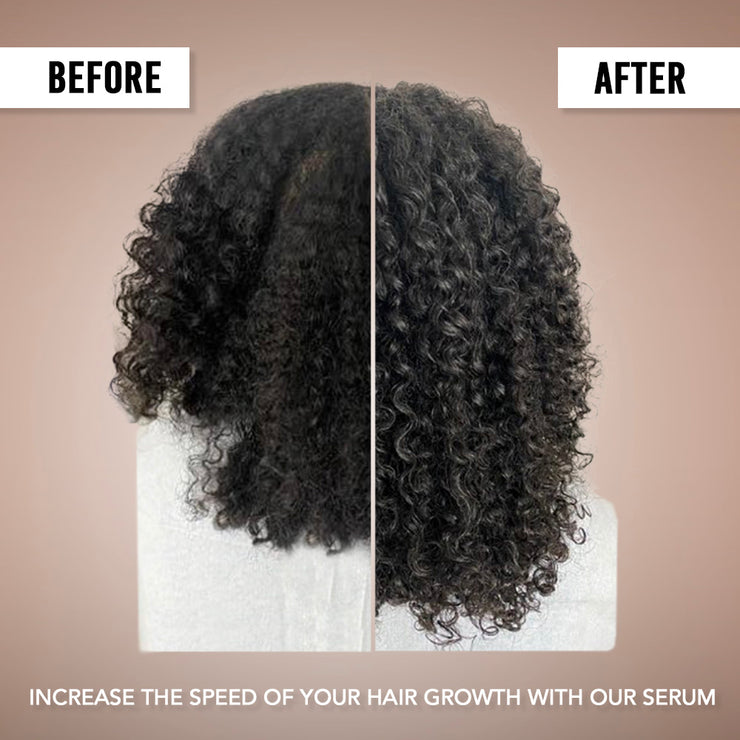 Hair Growth Serum [Pack of 3]