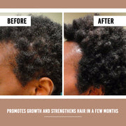 Hair Growth Serum [Pack of 5]